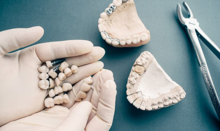 How to Safely Remove Dental Cement from Crowns
